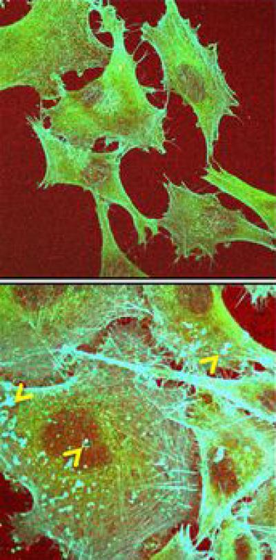 Transcription Factors Regulating Blood Oxygen Linked to Melanoma Metastases