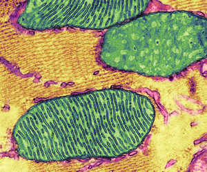 Mitochondrial pathway that leads to inflammation