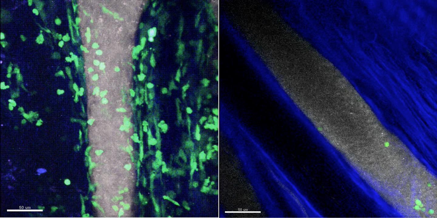 C5a Molecule Recruits Neutrophils into Joints in Inflammatory Arthritis