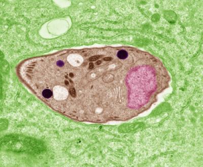 <I>Toxoplasma gondii</I>