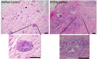 PTEN Cancer Stem Cells