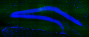 Observation of the dentate gyrus in the hippocampus of a mouse model