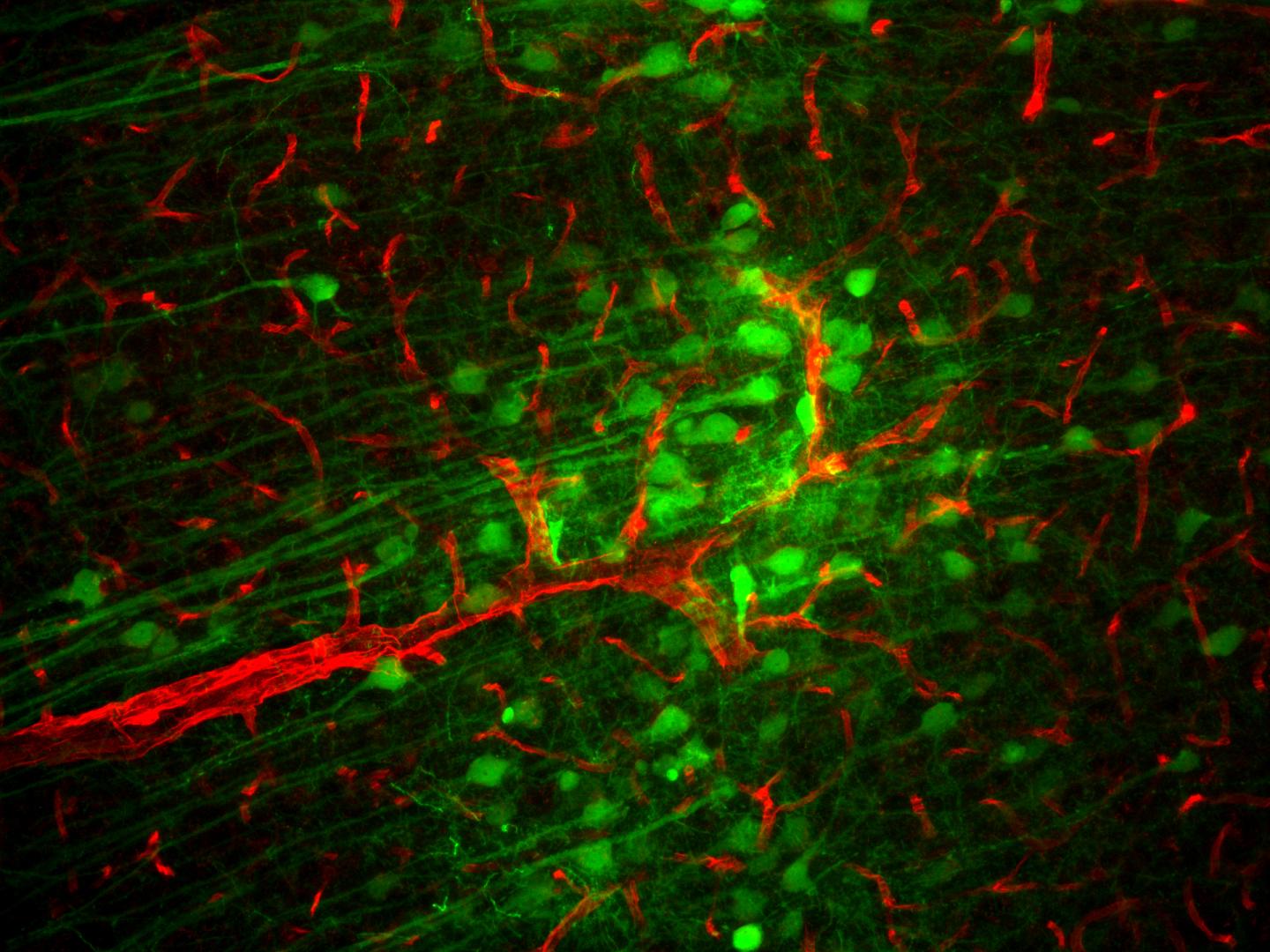 Physical Positioning Dramatically Enhances Brain Transduction After Intrathecal AAV9 Infusion (2-7)