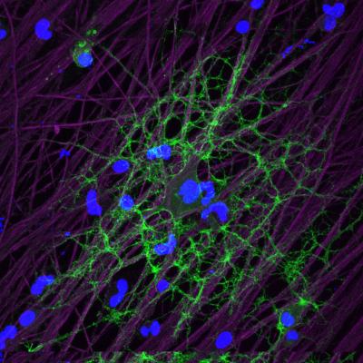 How Myelination Keeps in Tune with Neuronal Activity (2 of 4)