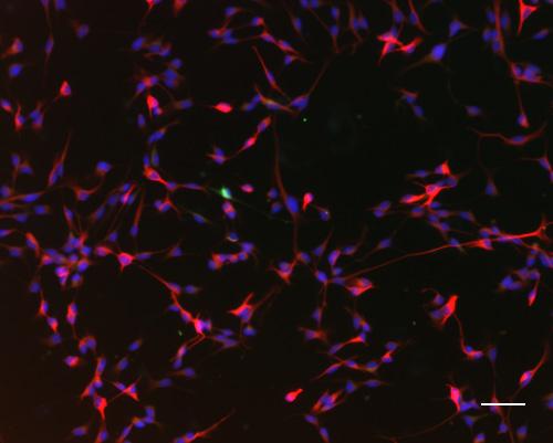 Hippocampal precursor cells