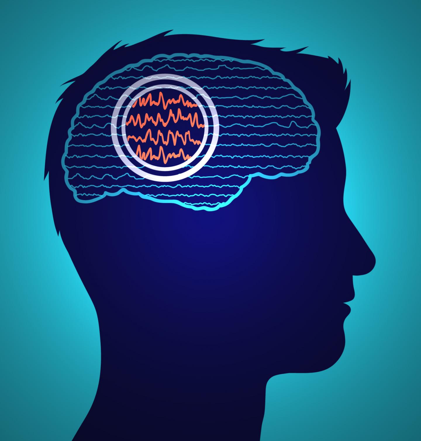 Epilepsy Seizure Research Image