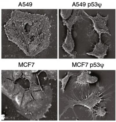 Switching Side in Cancer (2 of 2)