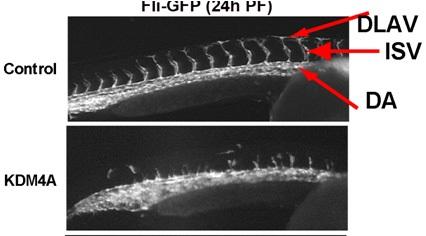 Zebrafish Embryos with and without Blood Vessels