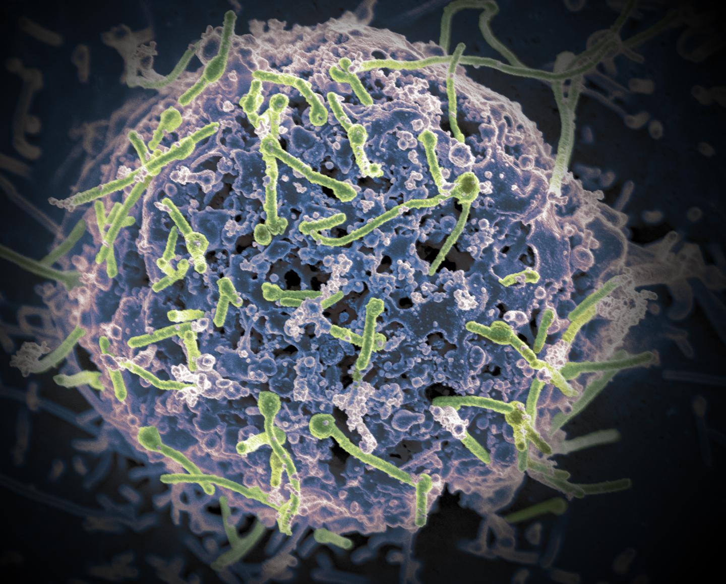 Ebola Virus Shown on Cell Surface