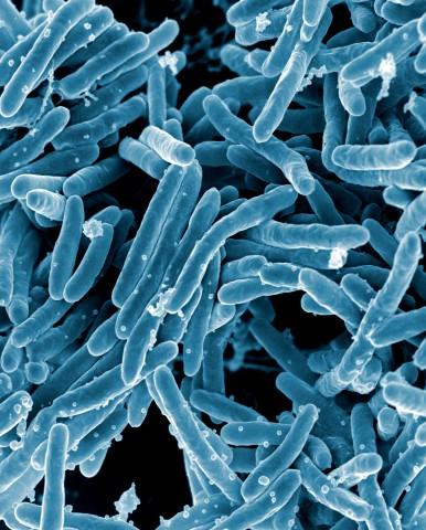 Micrograph of <i>Mycobacterium tuberculosis</i>