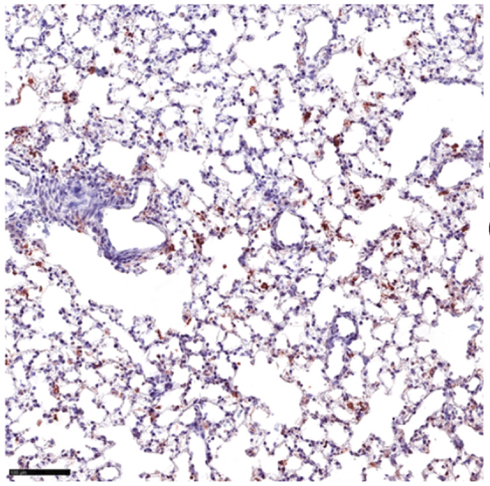 SARS-CoV-2 infection produces severe disease in aged mice