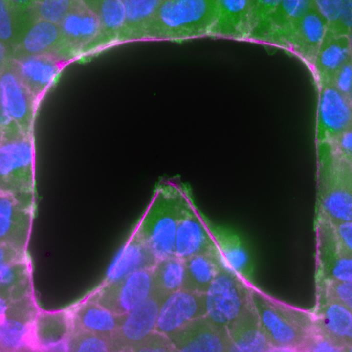 Epithelial Gap Closure Is Dictated by Gap Geometry