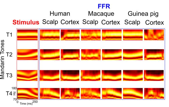 Frequency-following responses