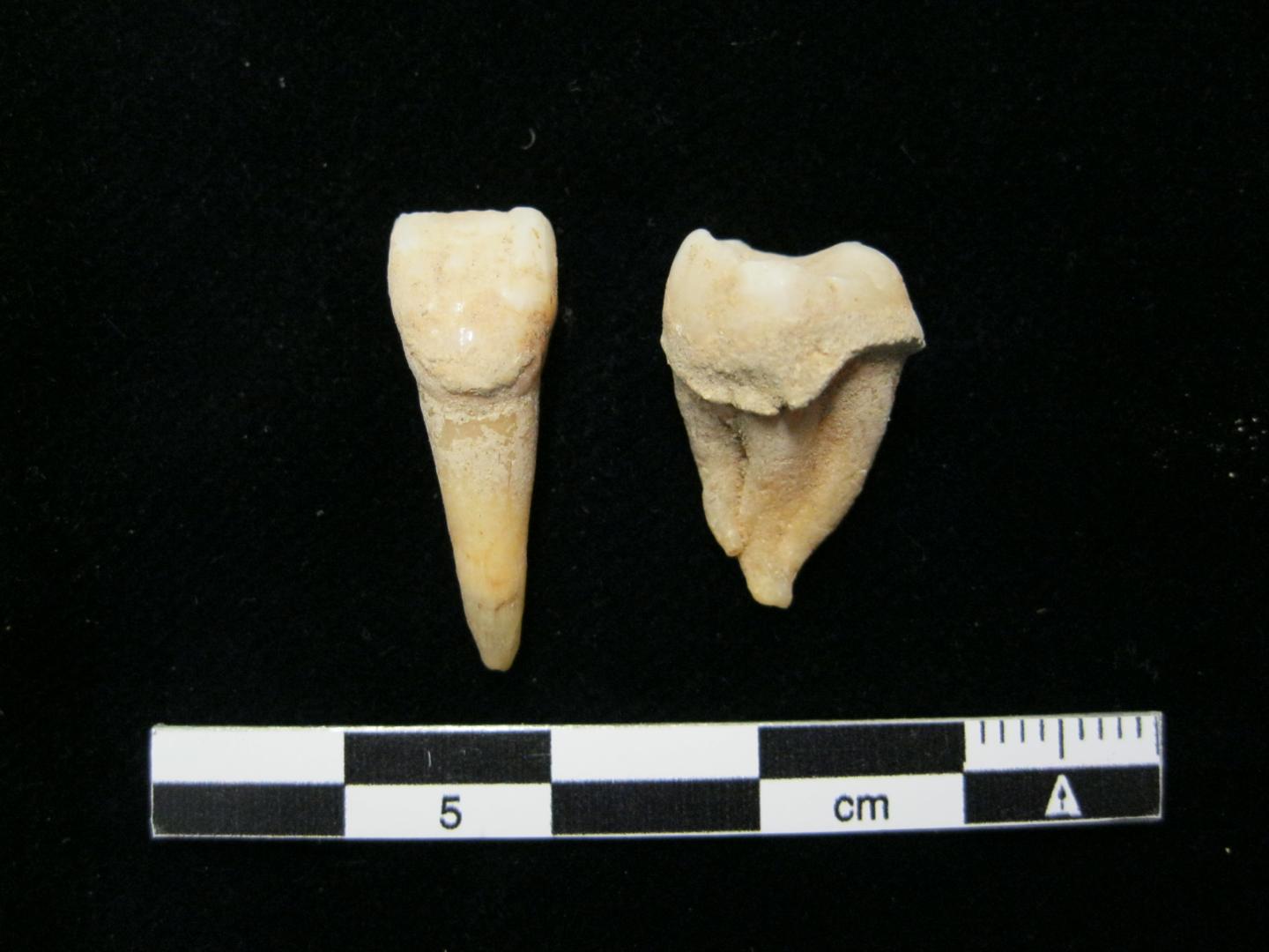 dental calculus archaeology