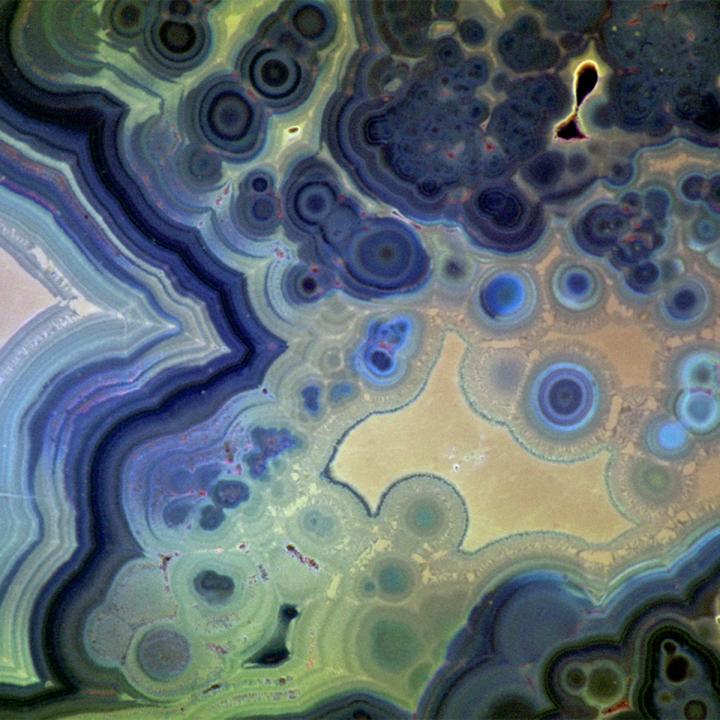 Kidney stone microspherules