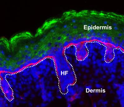 Tissue Architecture of Transplanted Skin Grafts
