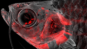 Confocal microscopy