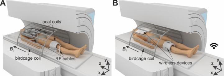 MRI