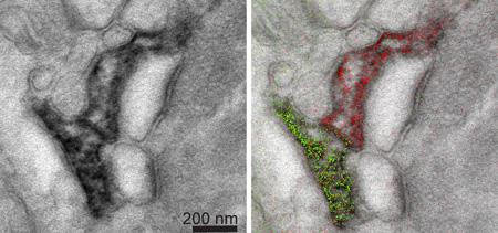 Hippocampal Astrocytes, UC San Diego, NCMIR