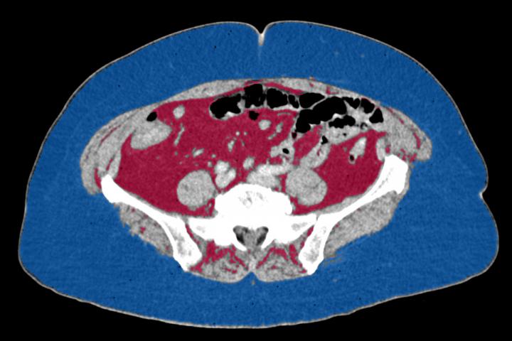 Cross-sectional CT Scan