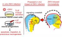 Zika and Cranial Neural Crest Cells