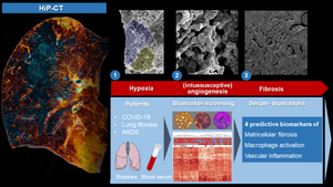 Long COVID and pulmonary fibrosis better understood  thanks to innovative techniques