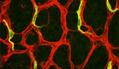 Immunofluorescence of Endothelial Cells