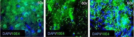 La Matrice Extracellulaire(Marquée En Vert) Entoure Les Cellules Cérébrales (Noyaux Marqués En Bleu)