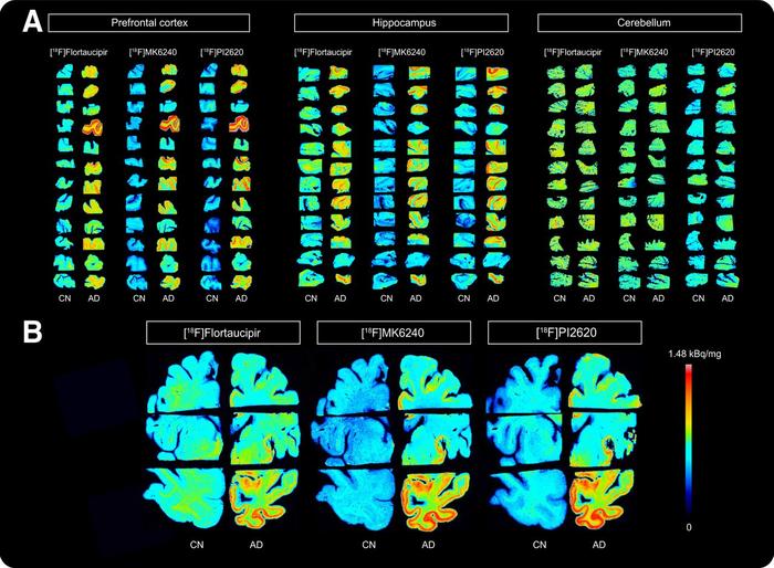 Autoradiography images showing binding of three tau radiotracers.