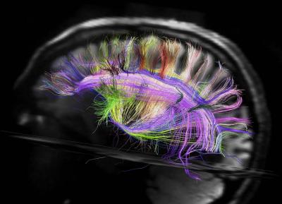 Neuronal Fibers in Human Brain