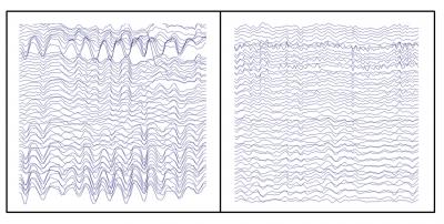 EEG's Reveal Video Game Aptitude (2 of 2)