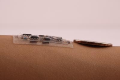 Miniaturized Mobile Health Monitoring (2 of 9)