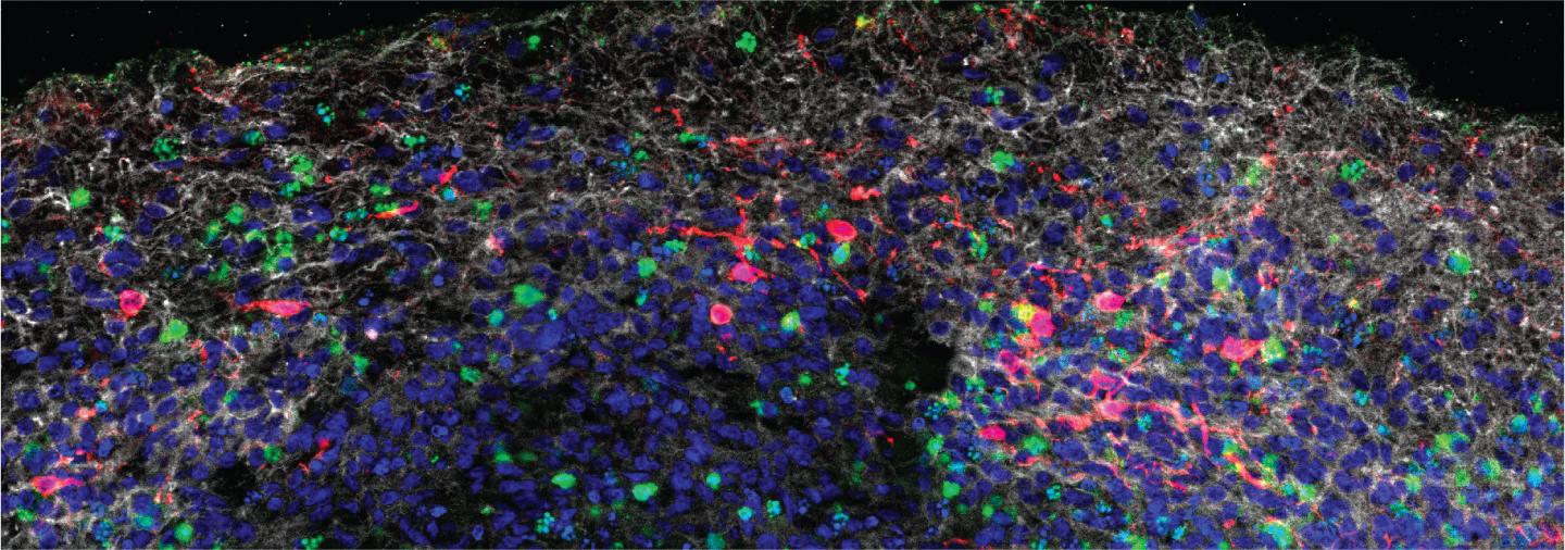 SARS-CoV-2 Infection of Human Brain Organoids