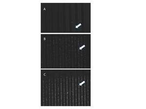 Capture of Mycobacterium tuberculosis bacterial particles on the edges of the electrodes by dielectrophoresis using the CAPTURE-XT® chip