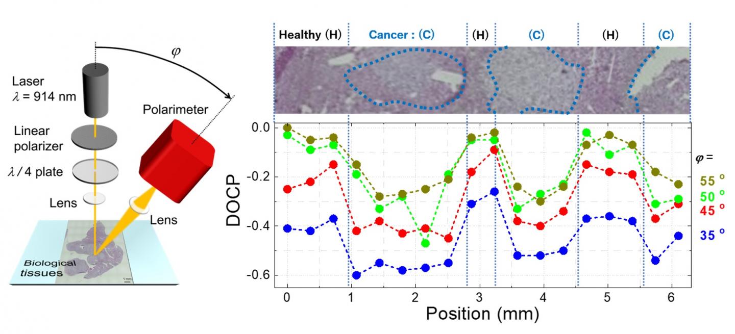 Figure 2. Experimental demonstration of the cancer diagnosis technique in biological tissue