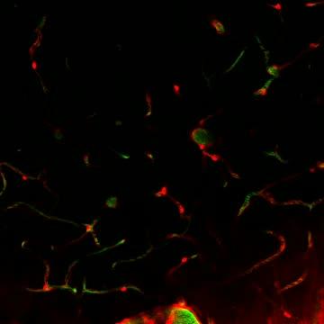 Blood flow through living brain