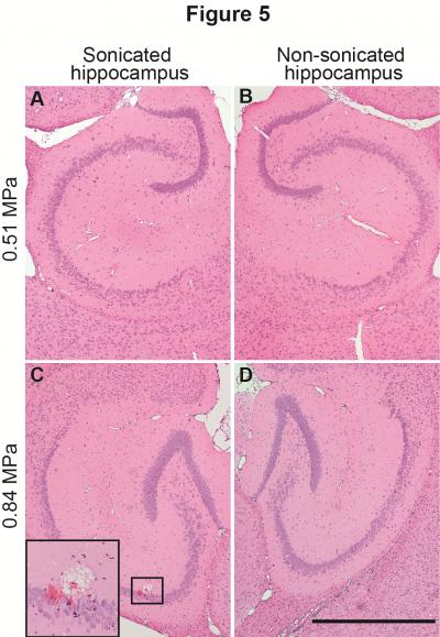 Damage Analysis of BBB-opened Brain Regions