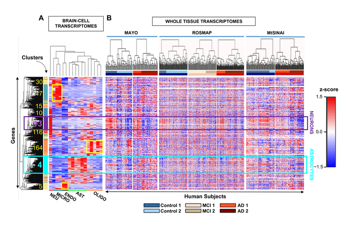 Researchers study how gene expression changes in the brain in Alzheimer's disease