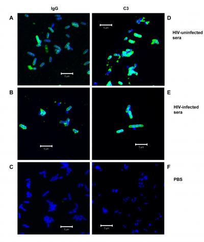 Why HIV Patients Are So Susceptible to Salmonella (2 of 2)