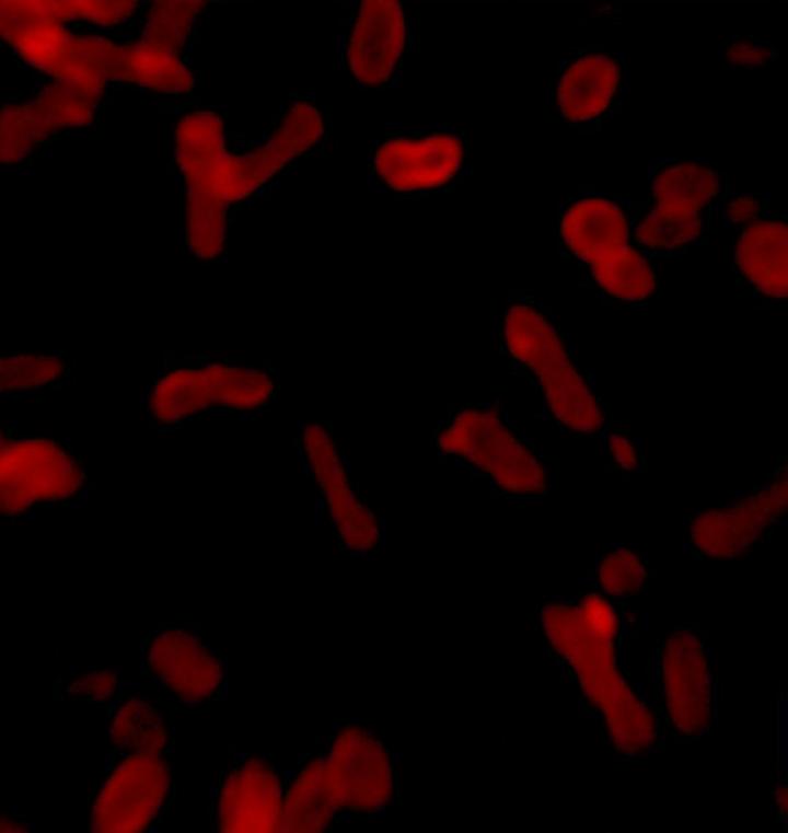 Non-Spherical Plastic Nanoparticles