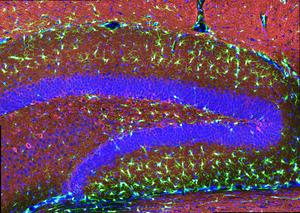 Transplanted Microglia