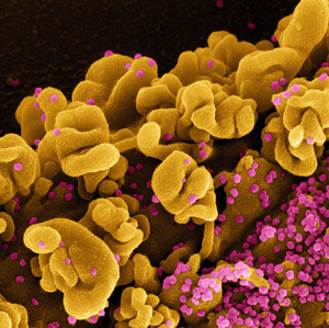 Omicron strain of SARS-CoV-2 virus particles