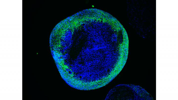 Human brain organoids with mature neurons in green (pos. for the marker MAP2)