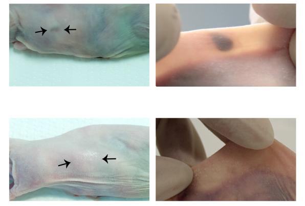 A Bioengineered Tattoo Monitors Blood Calcium Levels (2 of 3)