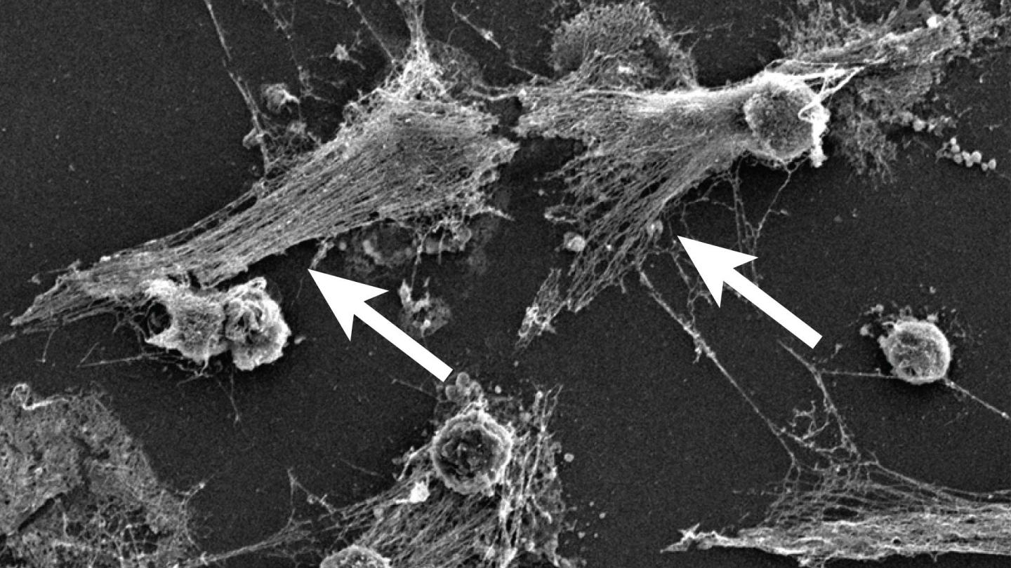 Neutrophils Forming NETs