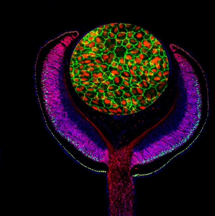 Combining multiple maps reveal new genetic risk factors for blindness