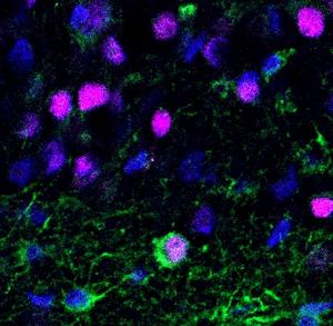 Newborn neuron in adult brain tissue