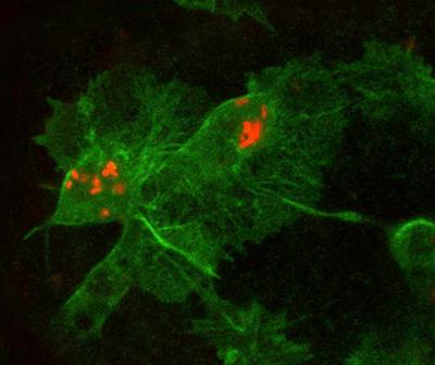 Immune Cells Attacking Bacteria