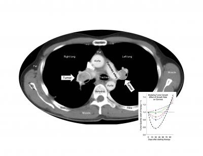 Reassuring Evidence: Anticancer Drug Does not Accelerate Tumor Growth after Treatment Ends (1 of 2)