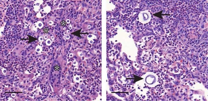 Inflammatory Monocytes Play Contradictory Roles in Fungal Infections